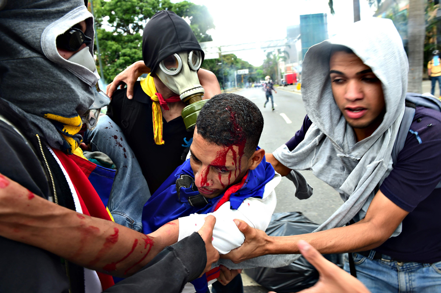 Otra jornada sangrienta en las calles de Venezuela. Foto: AFP