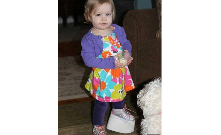 La pierna izquierda de Elsie sólo llegaba a la altura de su rodilla derecha. Foto: Foto: PA Real Life.