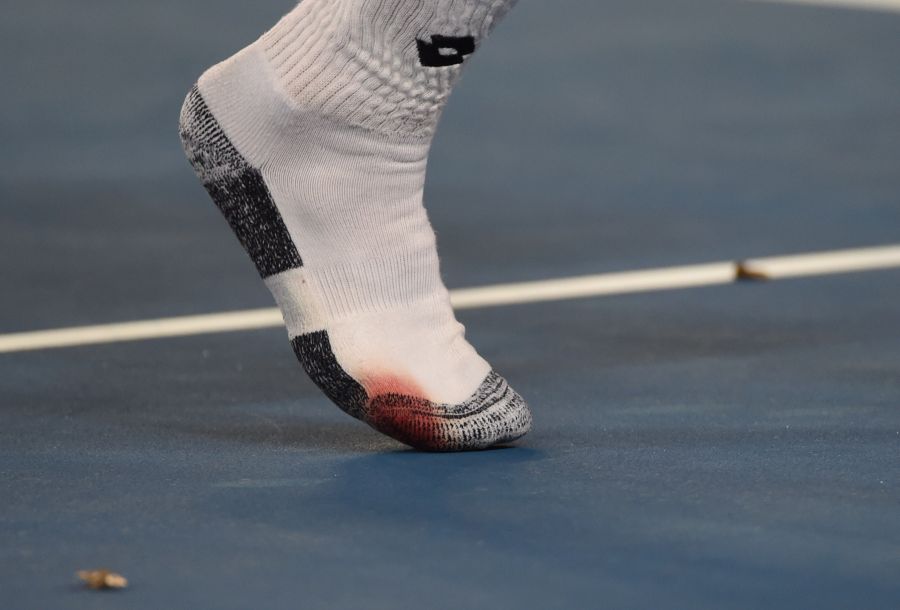 El francés hizo sangrar al español. Foto: AFP.