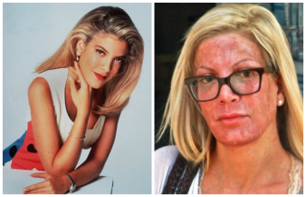 Tori Spelling, antes y después