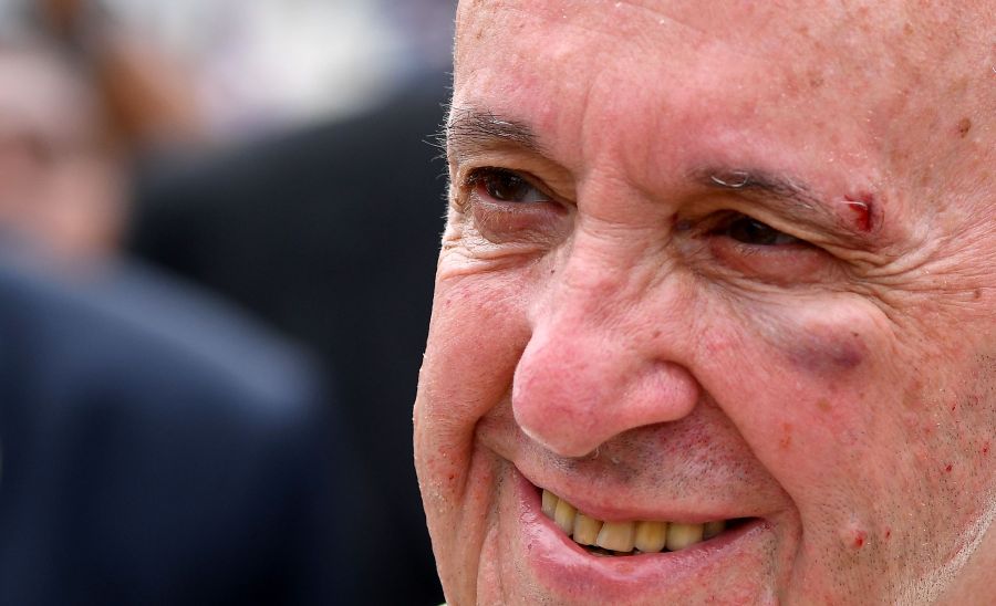 Francisco se tomó con humor el golpe sufrido. Foto: AFP