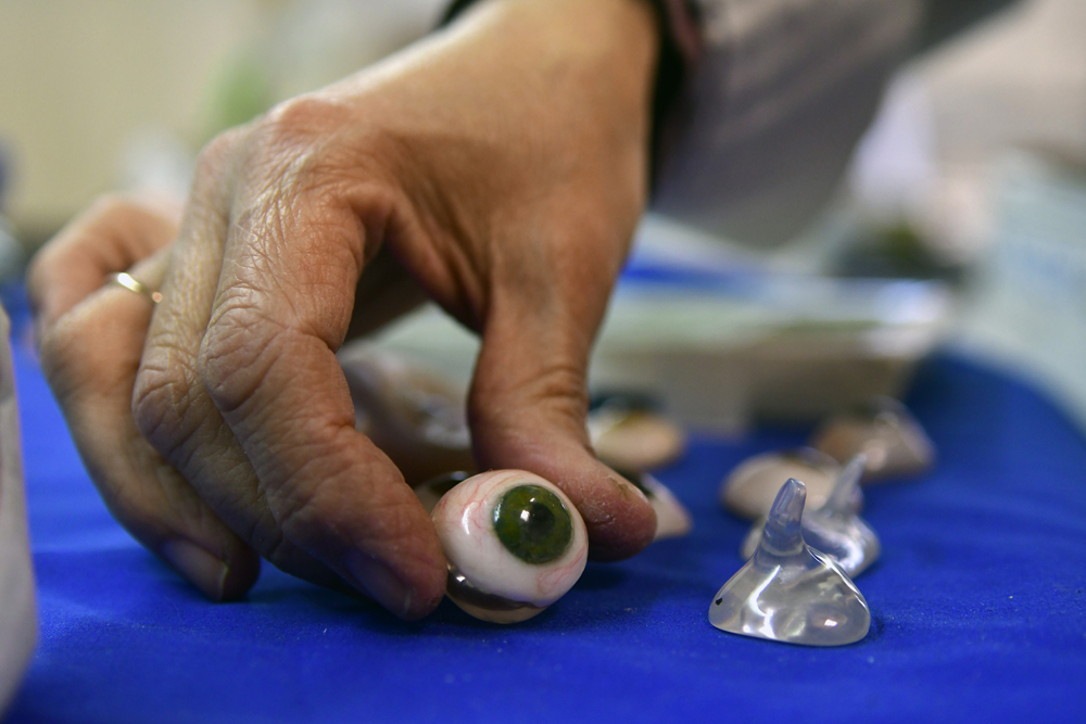 El servicio cuenta con una fonoaudióloga para rehabilitar pacientes. Foto: F. Ponzetto