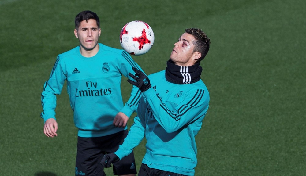Cristiano Ronaldo en el entrenamiento del Real Madrid con el ojo morado. Foto: EFE