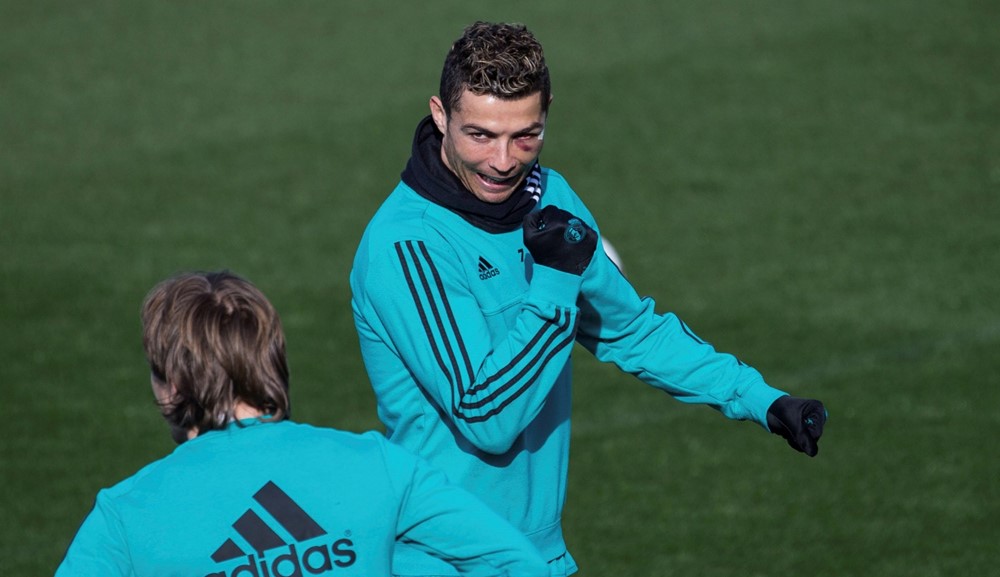 Cristiano Ronaldo en el entrenamiento del Real Madrid con el ojo morado. Foto: EFE