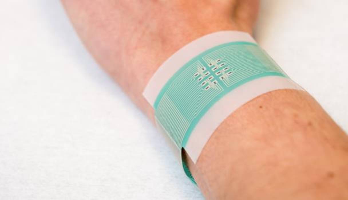 Parche para medir la glucosa. Foto: Universidad de Bath