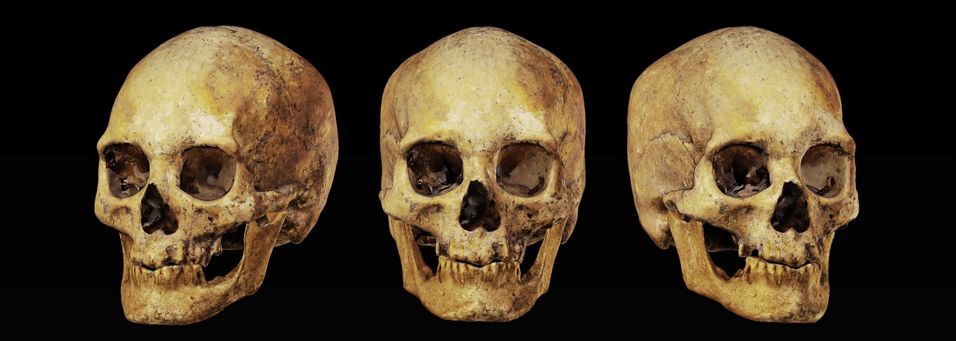 El cráneo prehistórico que será reconstruido. Foto: Museo de Arte Precolombino e Indígena