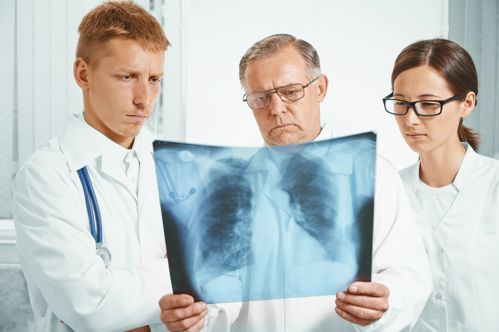 El problema más común que requiere un trasplante es la fibrosis quística. Foto: Shutterstock