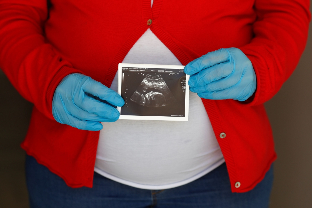 Embarazo y Covid-19