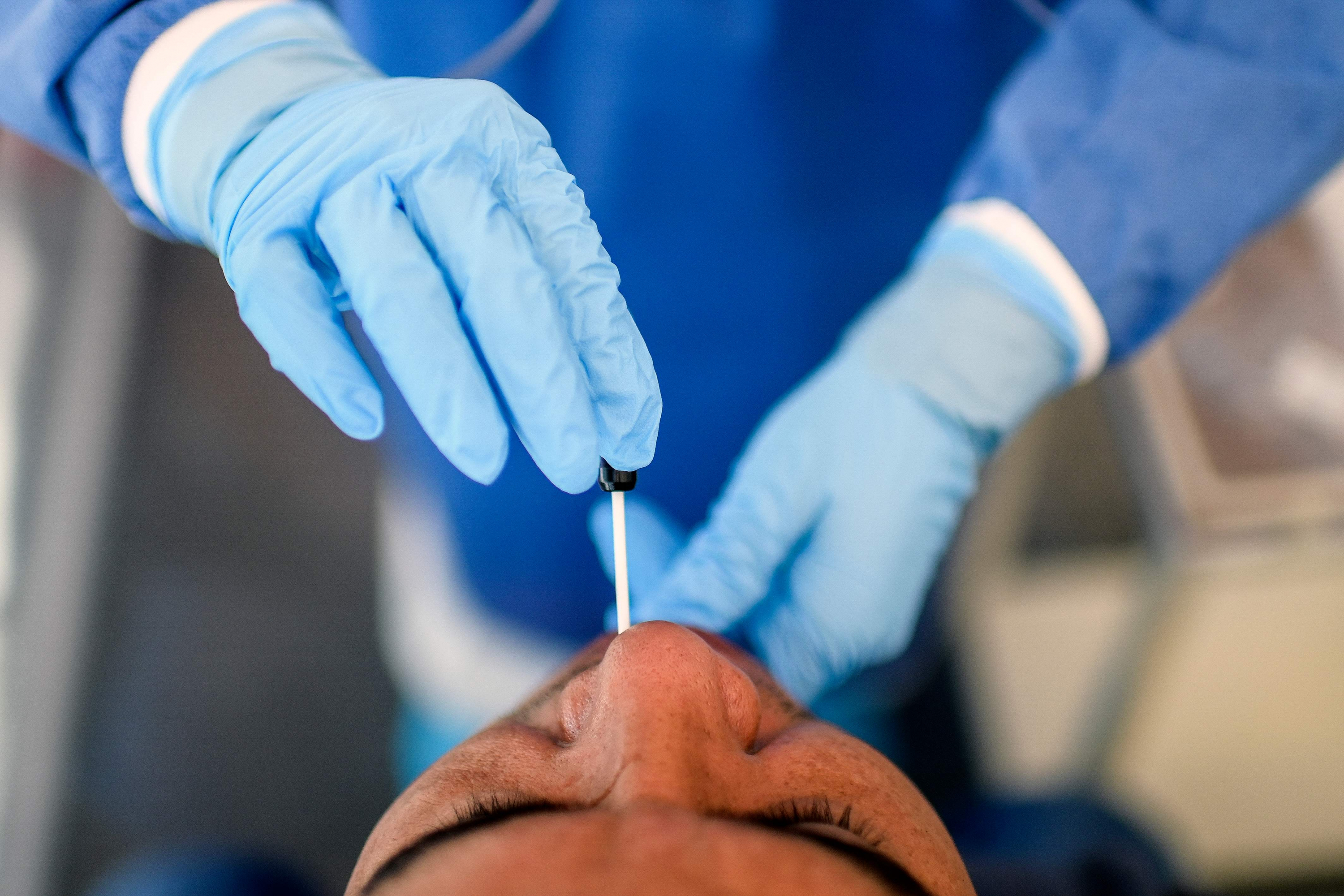 Test de coronavirus. Foto: AFP