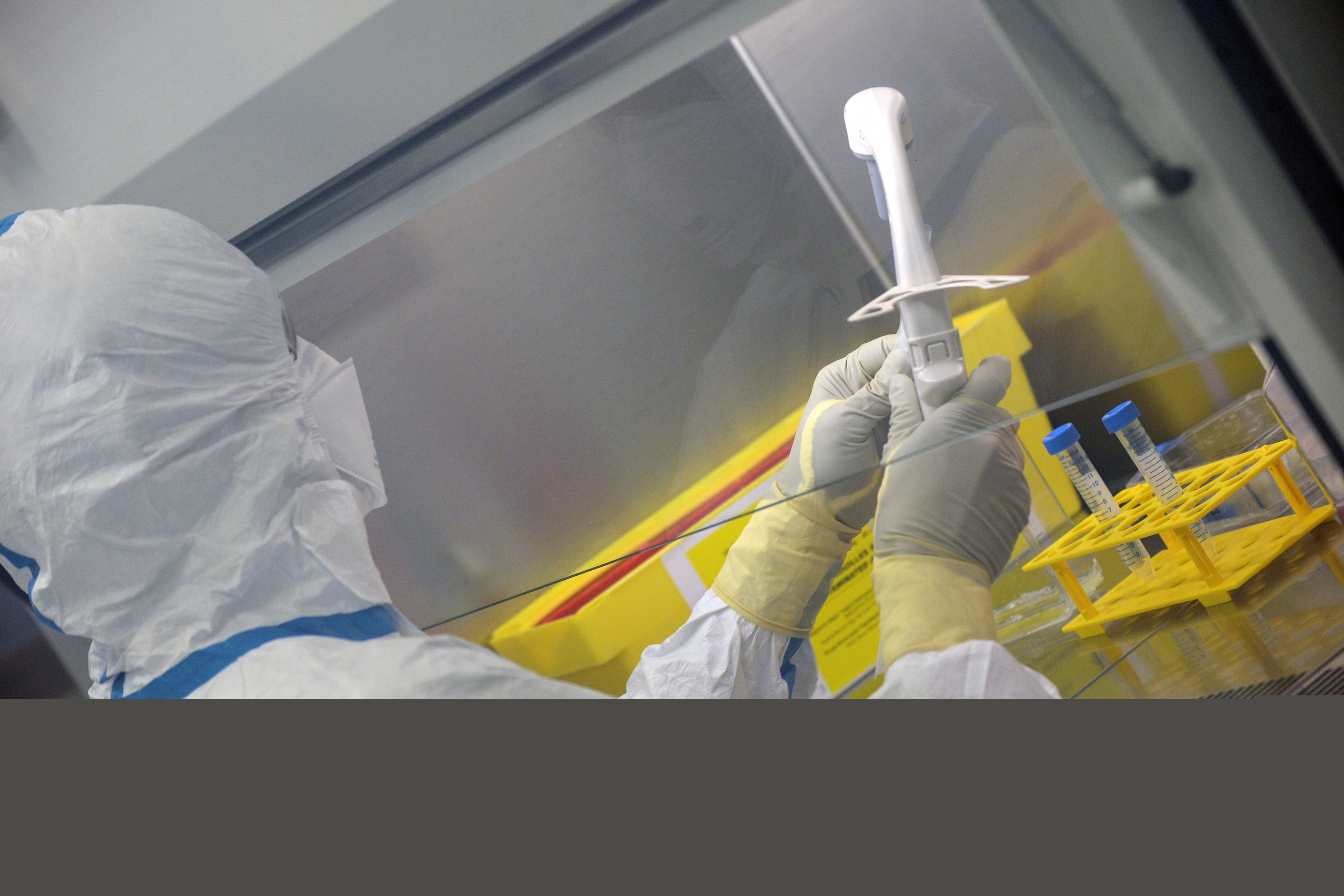 Estudios sobre el coronavirus COVID-19. Foto: AFP