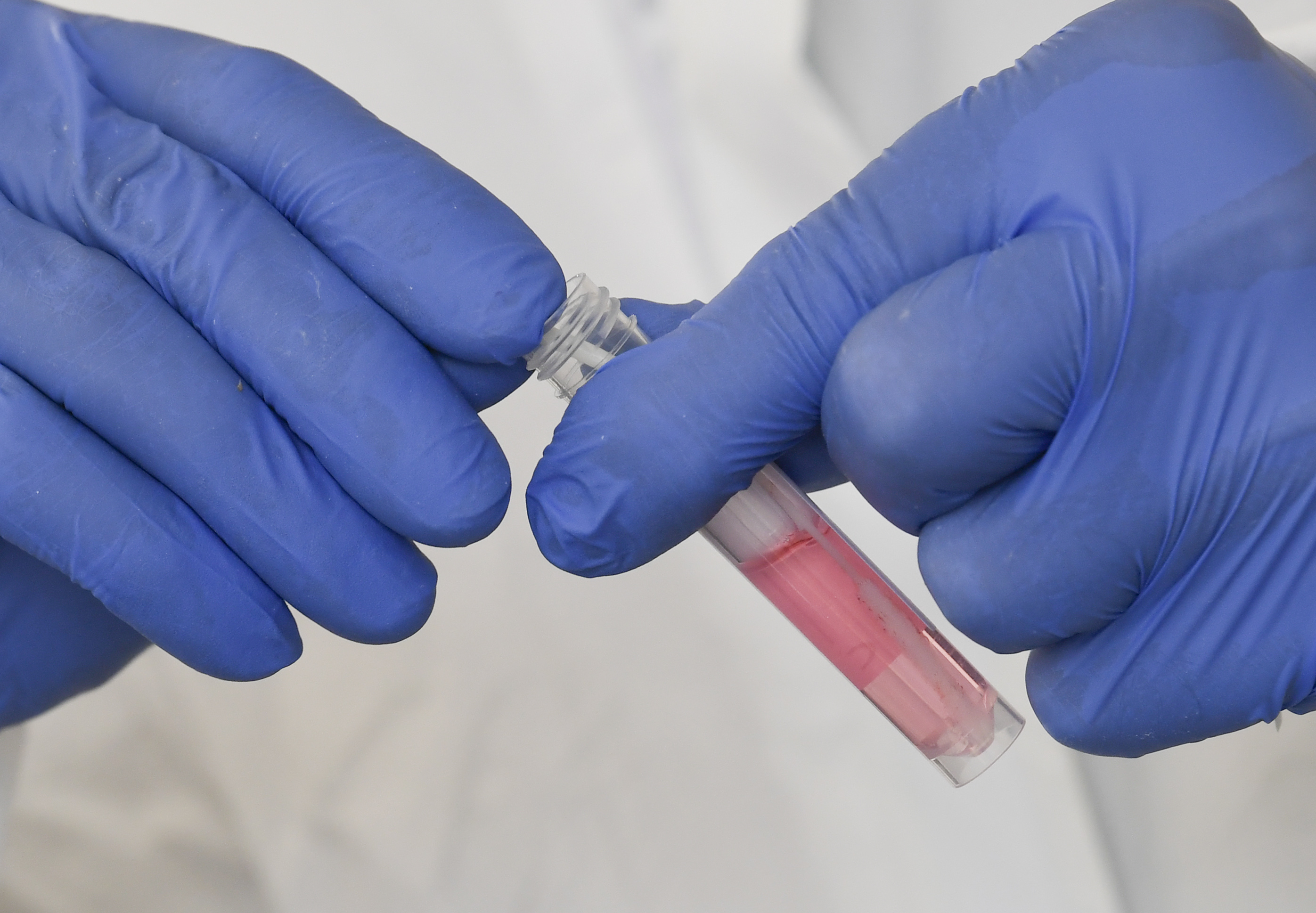 Test de COVID-19. Foto: AFP