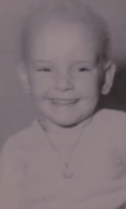 Mariela Ascione alopecia