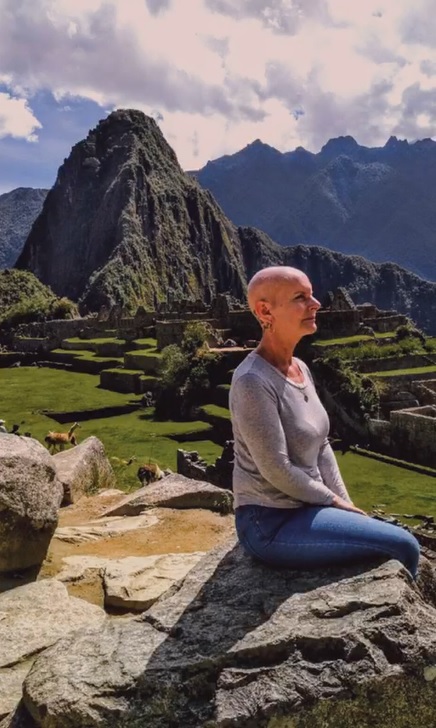 Mariela Ascione alopecia