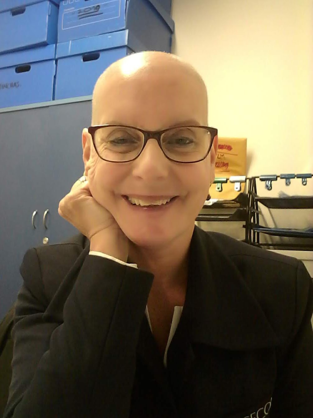 Mariela Ascione alopecia