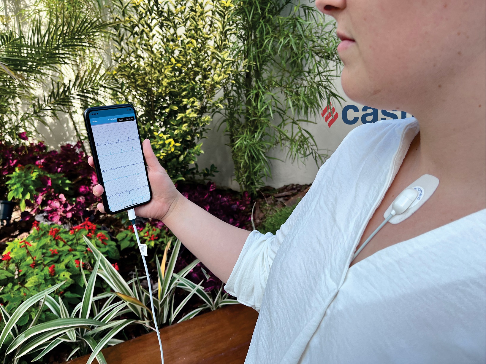 Casmu electrocardiograma