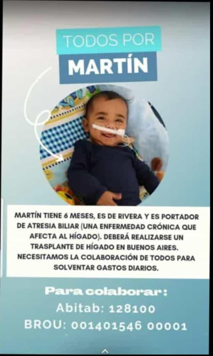 Todos con Martín: niño que padece atresia biliar